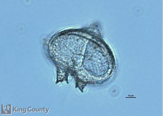 Photo of Protoperidinium depressum